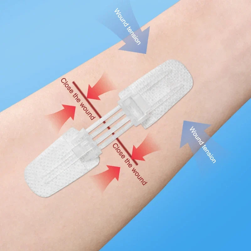 Zipper Bandage Wound Closure Patch | Suture-Free First Aid Dressing