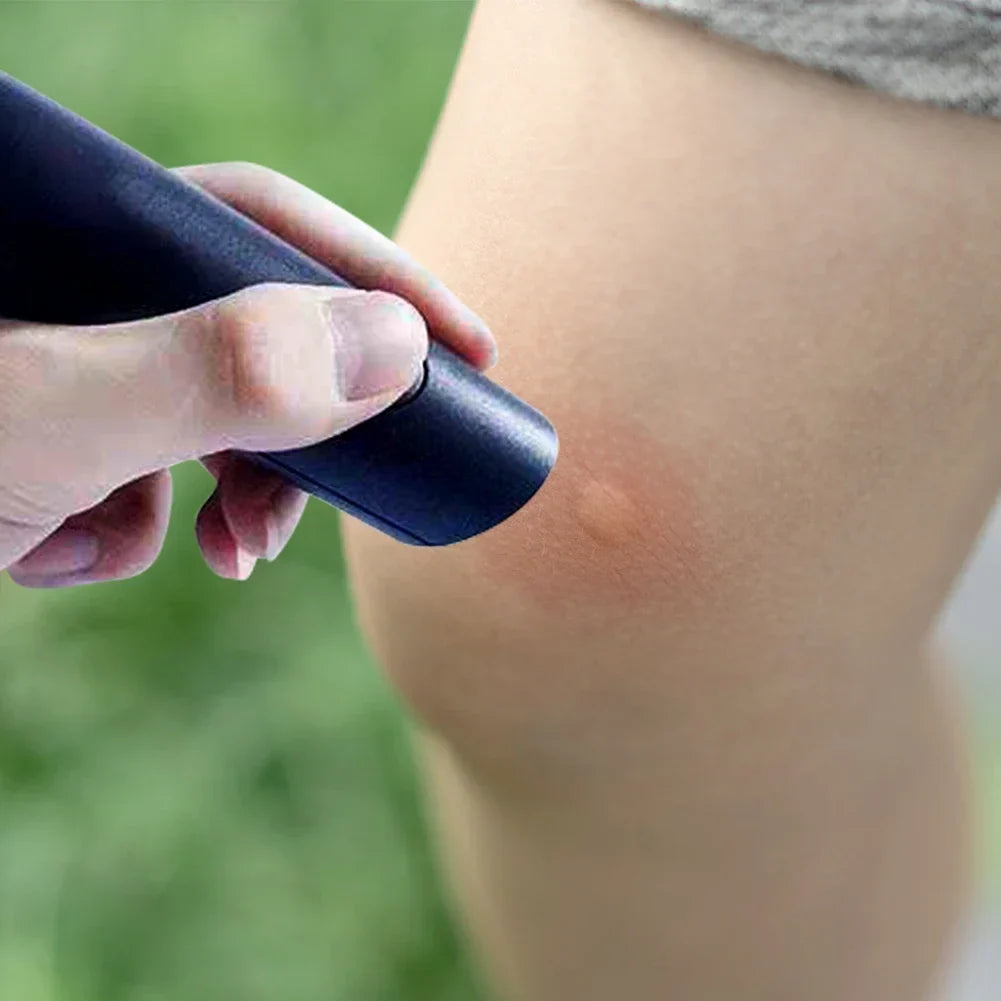 Electronic Insect Bite Relief Pen | Heat Pulse Itch Stopper for Mosquito Bites