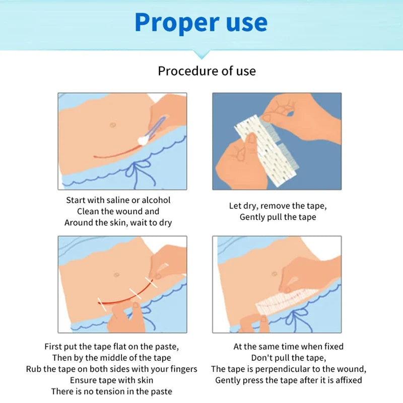 5 Strips Wound Skin Closure Strips | Medical Suture Free Surgical Tape